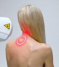 Terapia de láser de grandes áreas, escáner de láser, tratamiento de láser, dolor de espalda